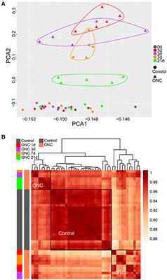 Transcriptome Analyses Reveal Systematic Molecular Pathology After Optic Nerve Crush